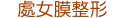 處女膜整形
